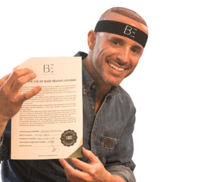 Hair Transplant Turkey